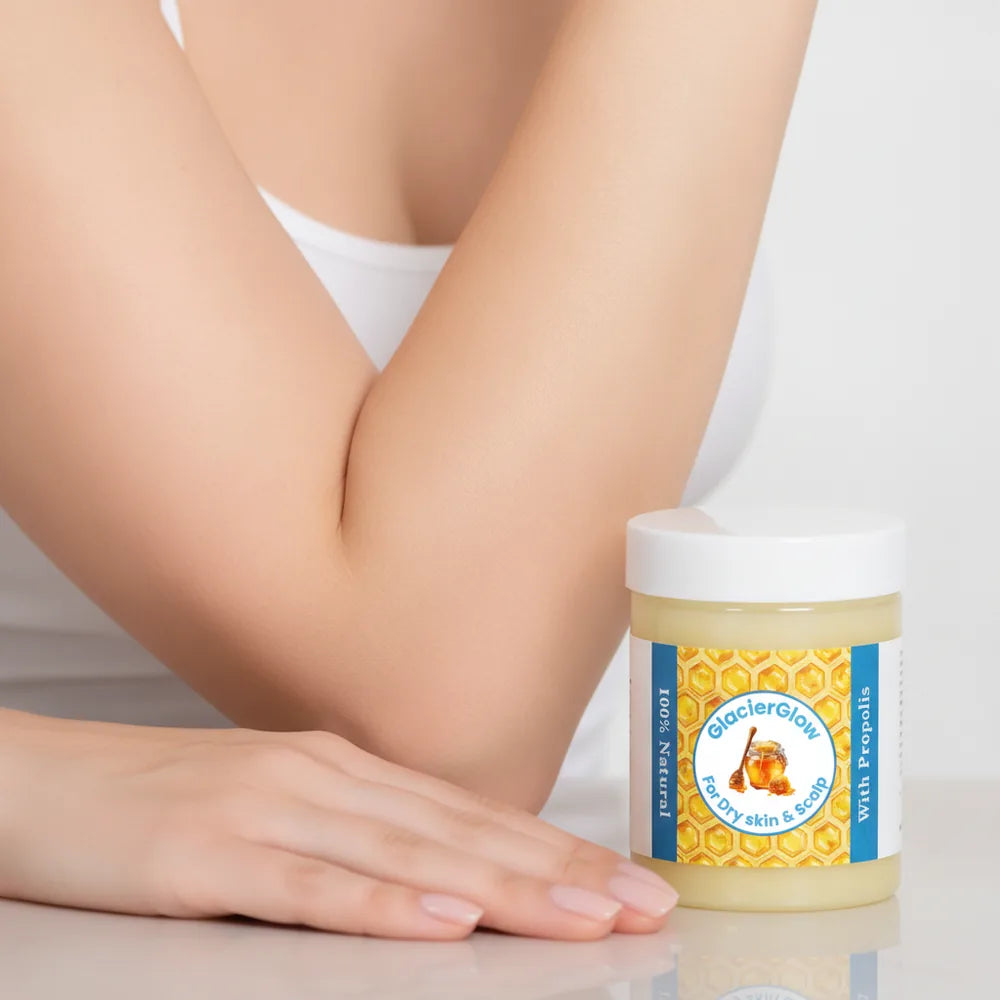GlacierGlow Bálsamo Natural 🍯 Para Piel con Eczema y Psoriasis