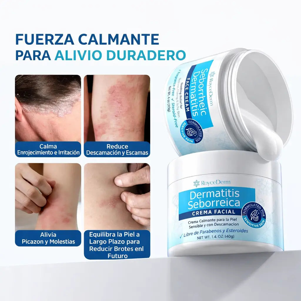 RoyceDerm Seborrheic Dermatitis