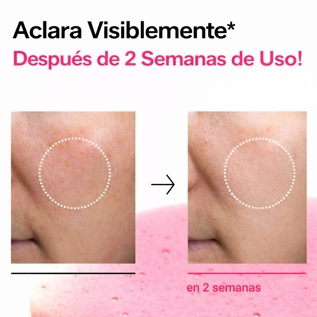 ✨ Dile adiós al tono disparejo y recupera una piel visiblemente más luminosa I Niacinamide 10 TXA Serum 30ml