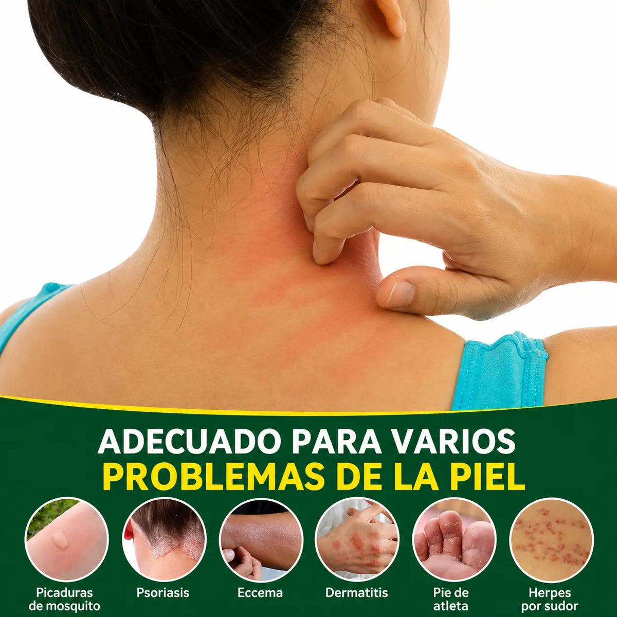 SanNuo Crema Alivio Picazón e Irritación en la Piel