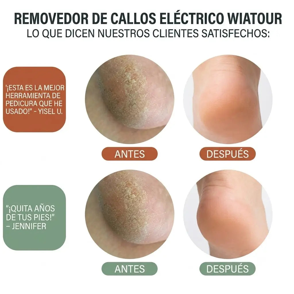Removedor de Callos Eléctrico Pro