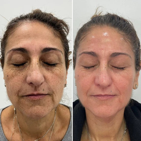 Kit X4 Unidades: La Mascarilla Nocturna que Ayuda a Recuperar la Elasticidad y Luminosidad